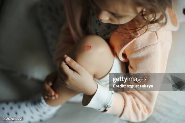 child's feet with injuries and scratches. kid with injured knees and wounds on a gray background. - battered child syndrome stock pictures, royalty-free photos & images