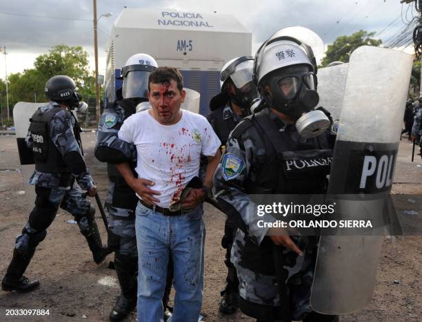 Bleeding activist is arrested by riot police during a demonstration of teachers in Tegucigalpa, August 27, 2010. AFP PHOTO/Orlando SIERRA