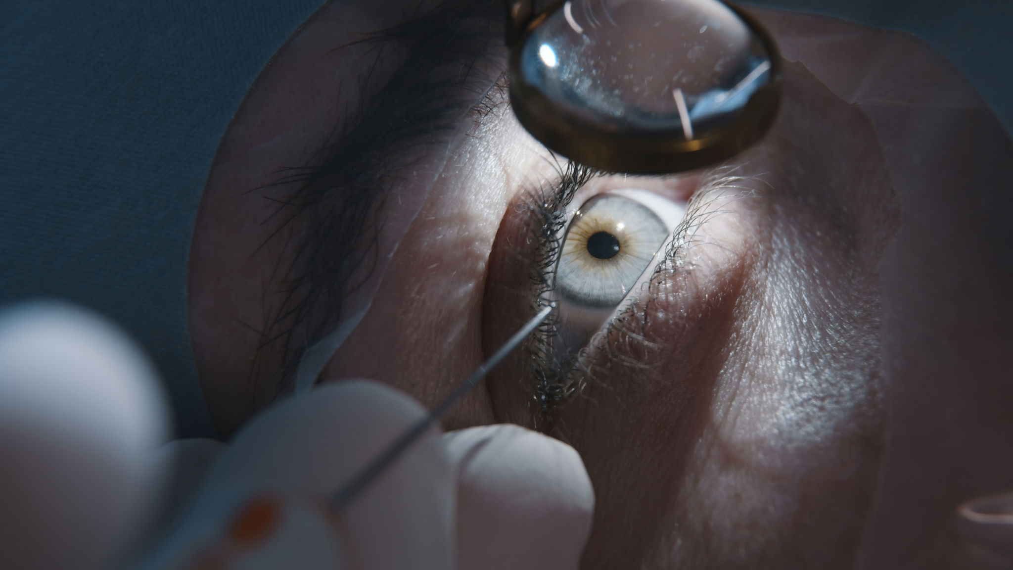 ophthalmologist