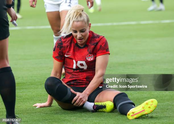 Canada forward Adriana Leon goes down to the ground after an injury in the first half during the CONCACAF Womens Gold Cup Group C - Canada vs Costa...