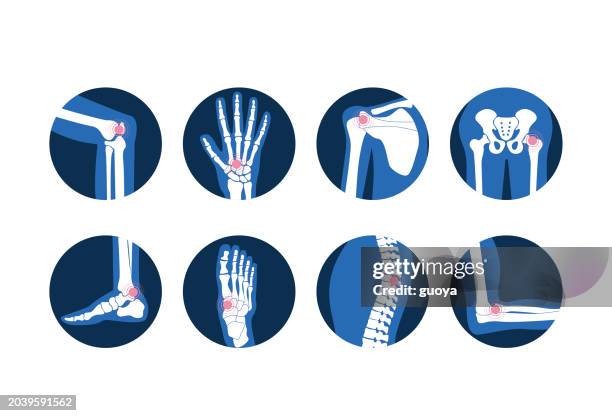 ilustraciones, imágenes clip art, dibujos animados e iconos de stock de icono de artritis ortopédica. - artritis