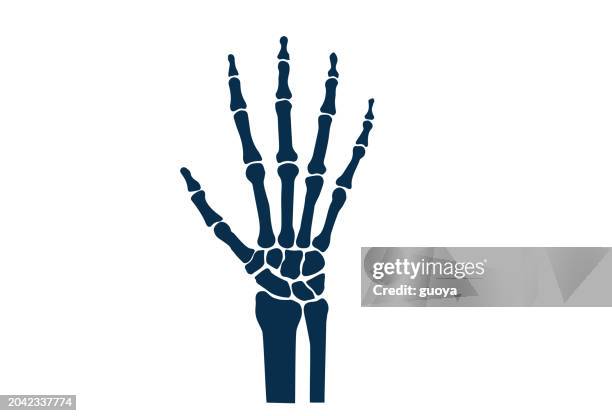orthopädisches symbol für das handgelenk. - skelett hand stock-grafiken, -clipart, -cartoons und -symbole