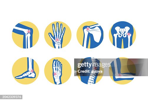 Orthopädische Arthritis-Ikone. Orthopädische Arthritis-Ikone.