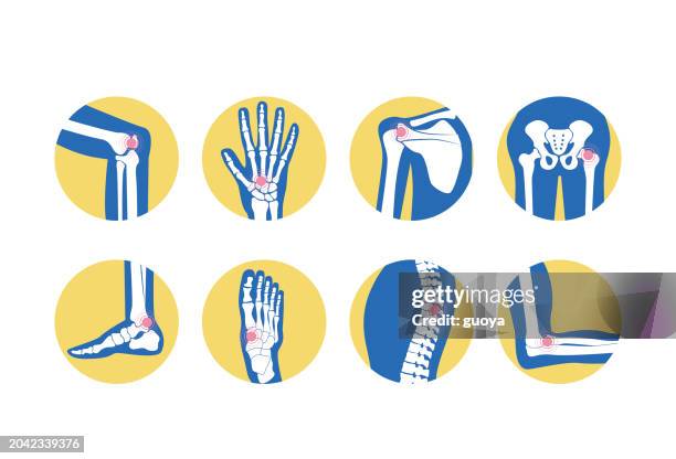 ilustraciones, imágenes clip art, dibujos animados e iconos de stock de icono de artritis ortopédica. - fibromialgia