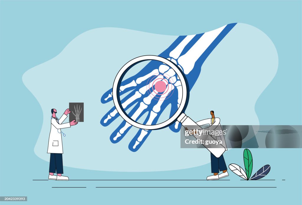 Dos médicos masculinos examinando las articulaciones de la palma de la mano, ilustración del concepto de protección de la salud ortopédica.