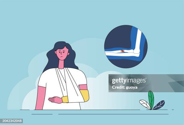 a woman suffered a broken arm. - broken arm stock illustrations