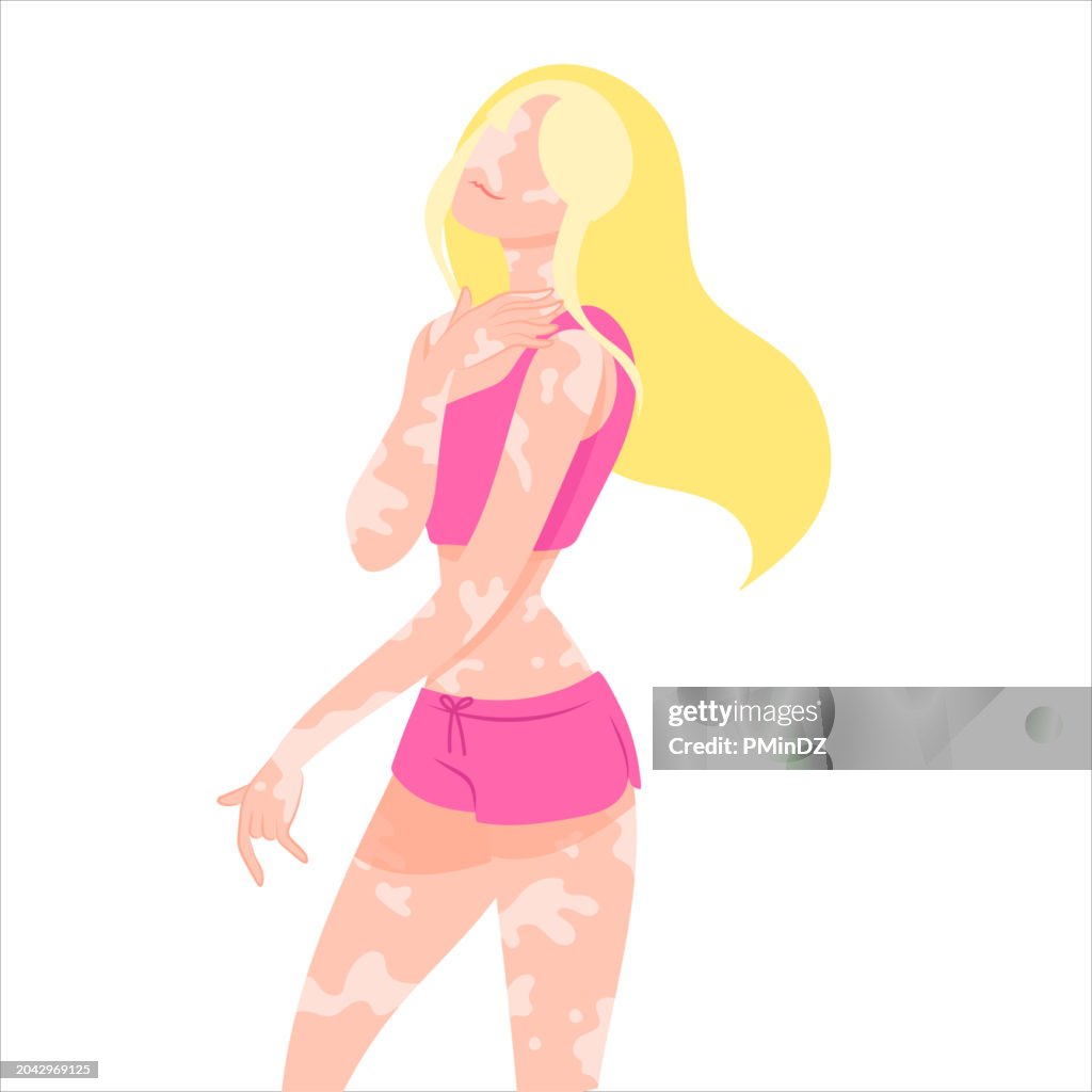 Ilustraciones de la piel del vitíligo