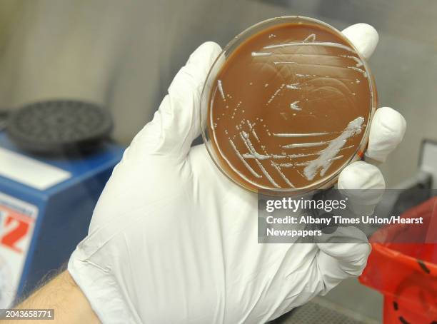 PhD. Student Brian Franz holds Francisella Tularensis bacteria growth on a chocolate agar plate under a hood in a lab where research is done on...