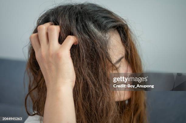 asian woman scratching her scalp caused of itchy scalp problem. - ugly asian woman stock pictures, royalty-free photos & images