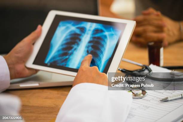 lung cancer concept. doctor explaining results of lung check up from x-ray scan chest on digital tablet screen to patien - lung cancer stock pictures, royalty-free photos & images