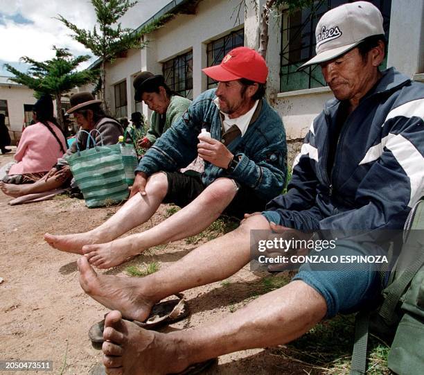 Group of retired people massage their calves in the yard of a public school in Patacamaya, 100 km from La Paz, Bolivia, after walking 20 km 20 March...