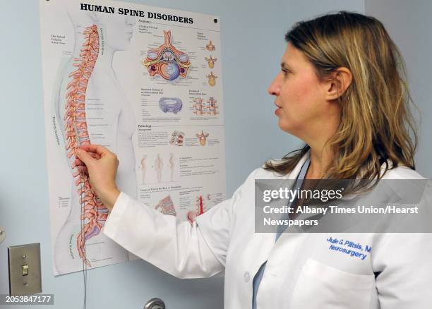 Dr. Julie Pilitsis shows where she implants a new spinal stimulation device using a poster in an examination room at Albany Medical Center on Monday,...