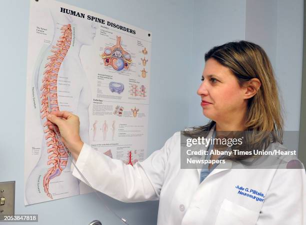 Dr. Julie Pilitsis shows where she implants a new spinal stimulation device using a poster in an examination room at Albany Medical Center on Monday,...