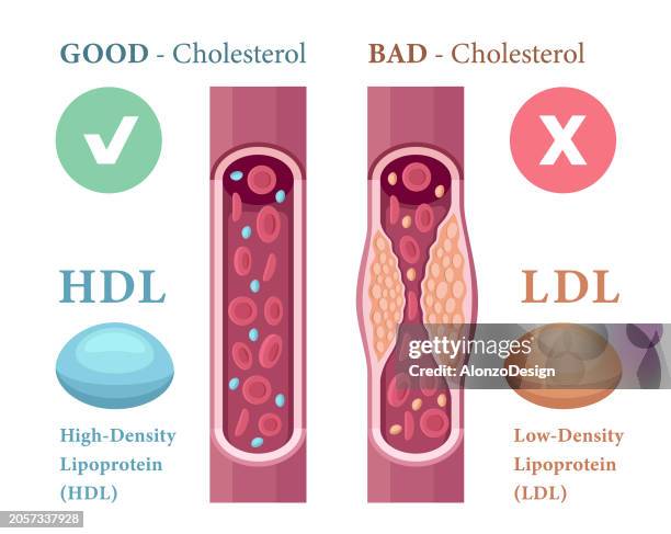 types of cholesterol in the blood concept. high-density lipoprotein (hdl) and low-density lipoprotein (ldl). - atherosklerose stock-grafiken, -clipart, -cartoons und -symbole
