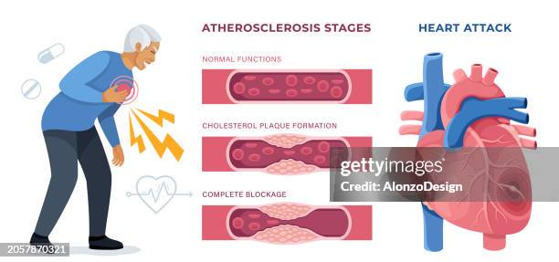 ilustrações de stock, clip art, desenhos animados e ícones de man suffering heart attack. recognizing signs of a heart attack. - ataque cardíaco