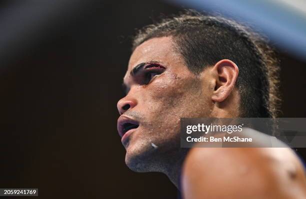 Eye Injuries In Boxing 2,438 Boxing Injury Stock Photos, High-Res Pictures, and Images - Getty ...