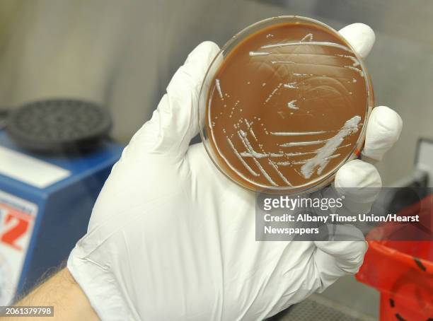 PhD. Student Brian Franz holds Francisella Tularensis bacteria growth on a chocolate agar plate under a hood in a lab where research is done on...