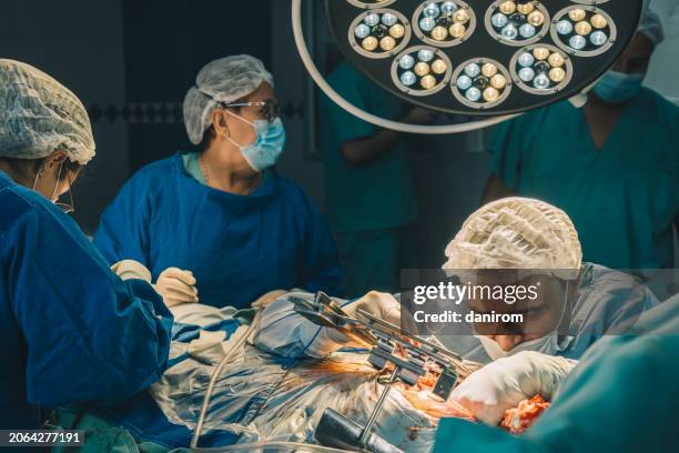 exhausted male surgeon performing open-heart surgery with full medical team assisting. - heart surgeon stock pictures, royalty-free photos & images