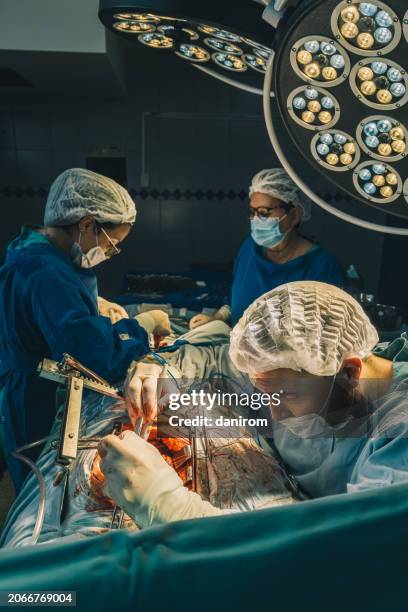 vertical shot of surgeons and assistant operating in the operating room. - heart bypass stock pictures, royalty-free photos & images