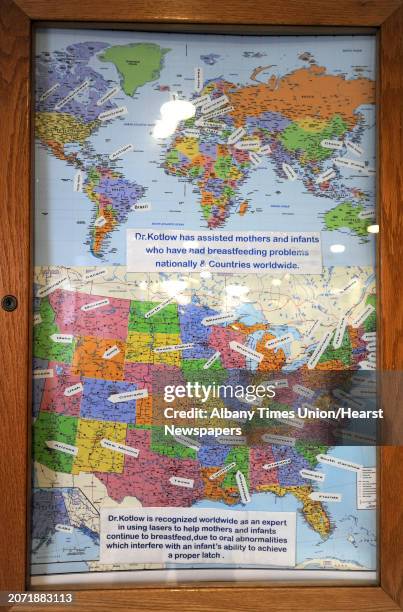 Map hangs in the office of Dr. Lawrence Kotlow showing how far patients have traveled to see him Friday, Jan. 16, 2015 in Albany, N.Y. Kotlow...