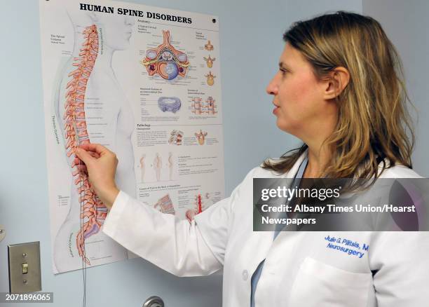 Dr. Julie Pilitsis shows where she implants a new spinal stimulation device using a poster in an examination room at Albany Medical Center on Monday,...