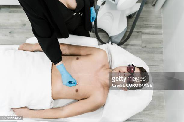 beautician painting lines where to use laser to remove hair if a male patient lying on stretcher - male hair removal stock-fotos und bilder