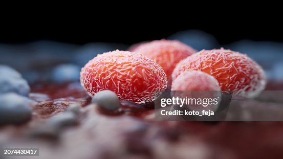 Viral Infection Monkeypox Virus Viral Infection Monkeypox Virus