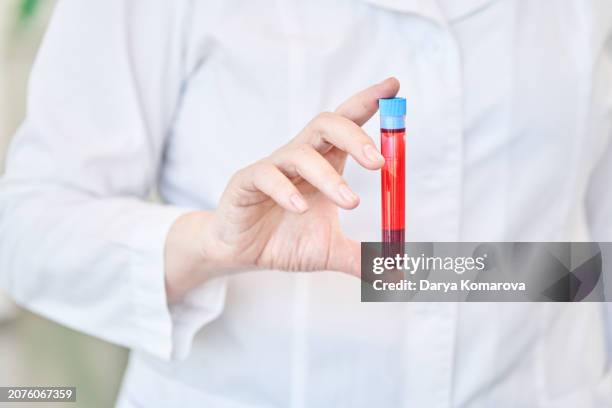 Blood Tubes In Hand 2,389 Blood Vial Hand Stock Photos, High-Res Pictures, and Images ...