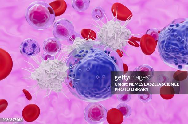 t cells attacking acute myeloid leukaemia cell, illustration - leukemia stock illustrations