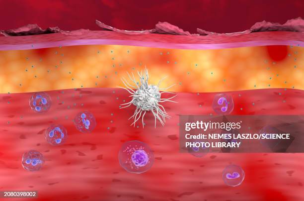 atopic dermatitis, illustration - atopic eczema stock illustrations