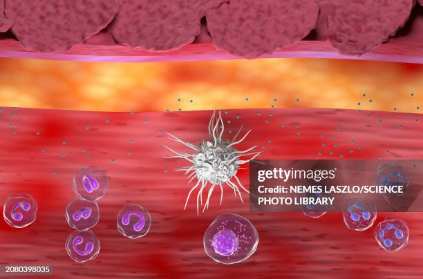 atopic dermatitis, illustration - dermatology stock illustrations