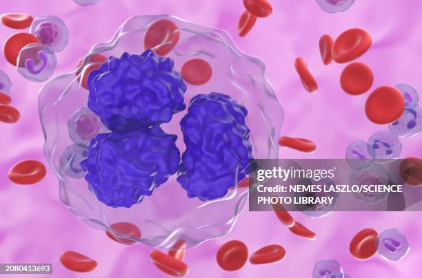 follicular lymphoma cells, illustration - team sport stock illustrations