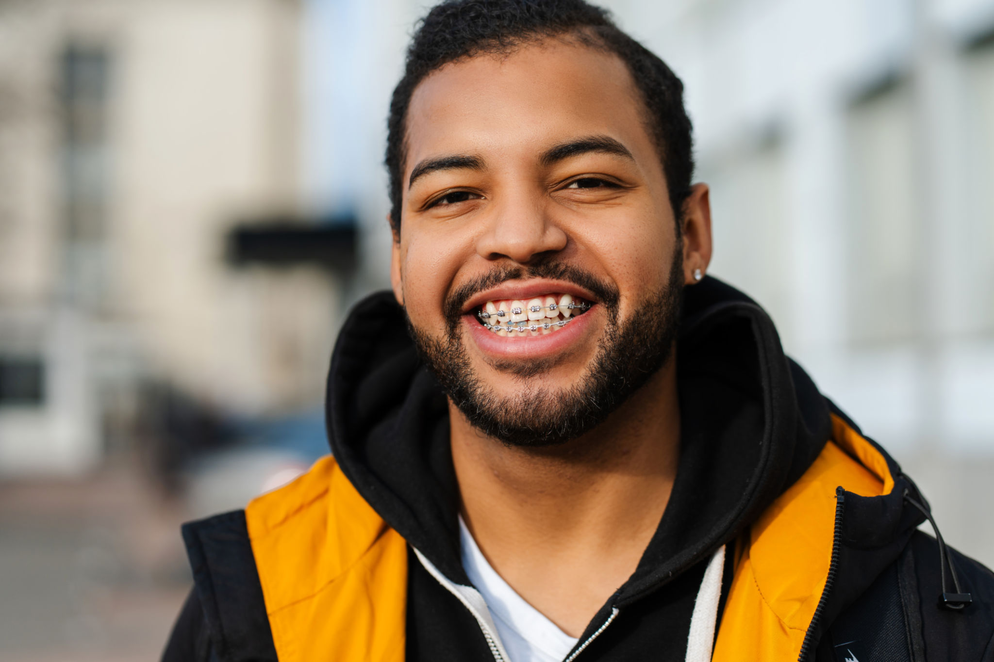 adult braces