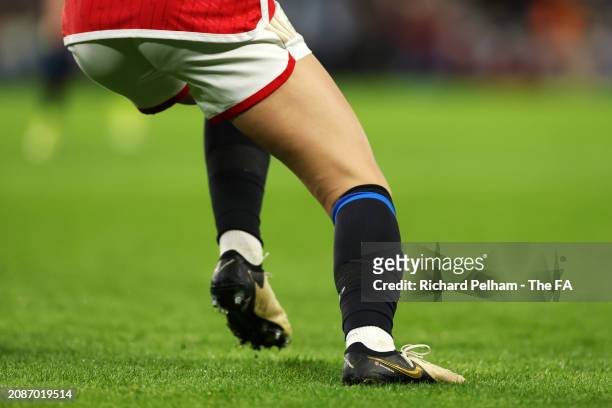 An Arsenal player is seen wearing black and blue socks after being forced to change colour socks which resulted in a delayed kick off time during the...