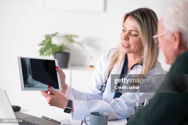 ärztin zeigt ihrem älteren patienten einen röntgenfilm von einem digitalen tablet - röntgenaufnahme stock-fotos und bilder