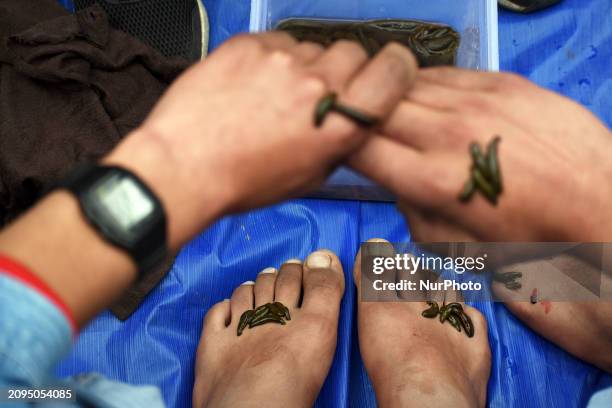 Local practitioner is placing leeches on the hands and feet of a man to suck impure blood as a means of skin treatment in celebration of Nowruz, the...