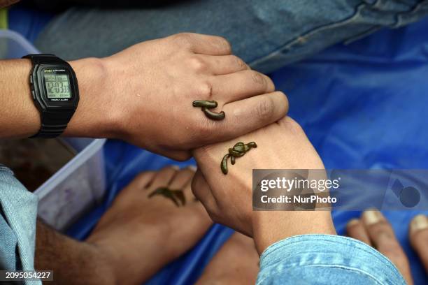Local practitioner is placing leeches on the hands and feet of a man to suck impure blood as a means of skin treatment in celebration of Nowruz, the...