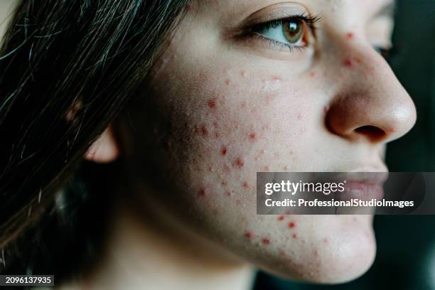 beauty in resilience - face dermatitis stock pictures, royalty-free photos & images