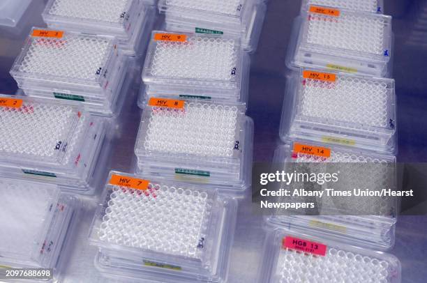 Absorbency Test Tray 155 Newborn Blood Screening Stock Photos, High-Res Pictures, and Images ...