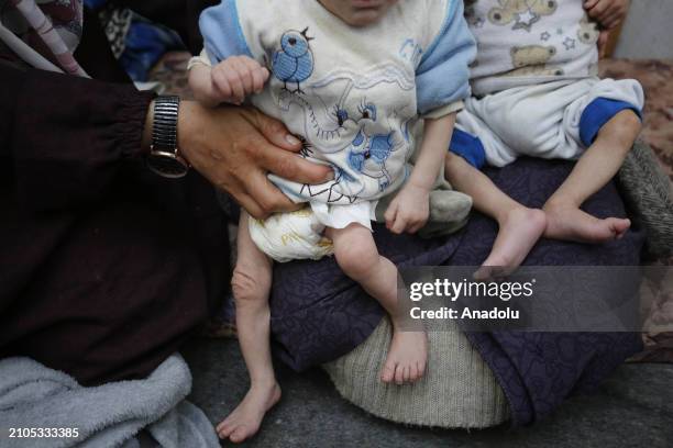 Baby triplets of Palestinian mother Nuzha Awad face the threat of dying from malnutrition and lack of medical care due to constant Israeli attacks...
