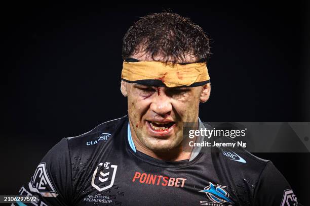 Dale Finucane of the Sharks walks off after receiving a cut during the round three NRL match between Wests Tigers and Cronulla Sharks at Leichhardt...