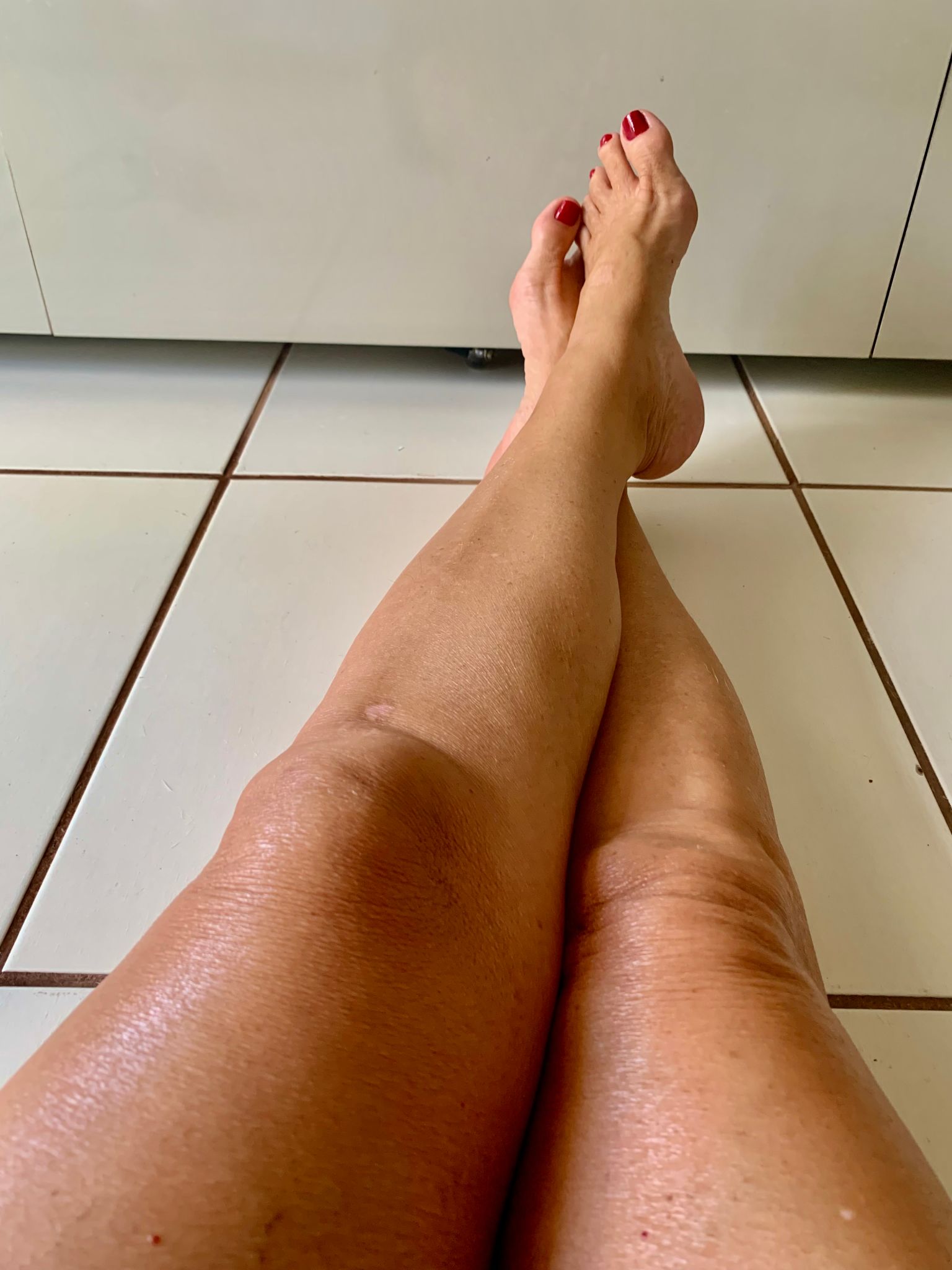veias pernas