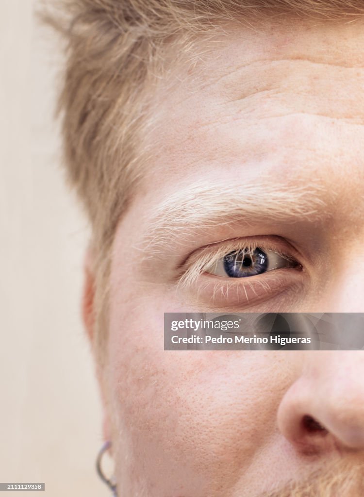 Close up portrait of an albino latino man