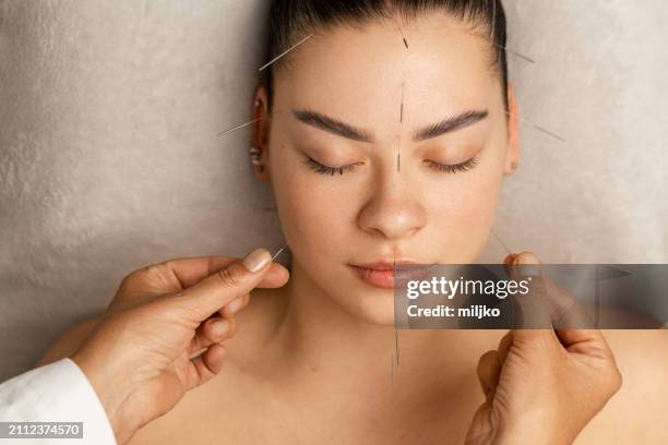 acupuncture face treatment - forehead stock pictures, royalty-free photos & images