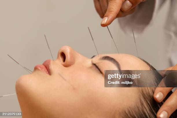 acupuncture face treatment - forehead stock pictures, royalty-free photos & images