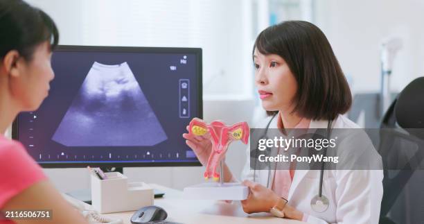 asian doctor uterine model explain - myometrium stock pictures, royalty-free photos & images