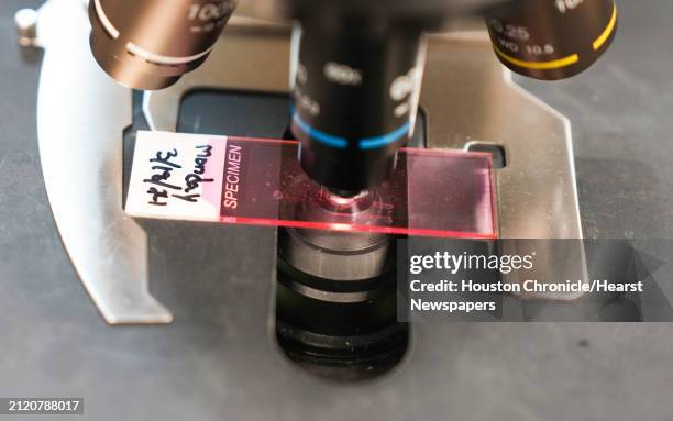 Slide of pollen and mold collected on Monday, March 18, is placed under a microscope at the Houston Health Department on Tuesday, March 19, 2024 in...