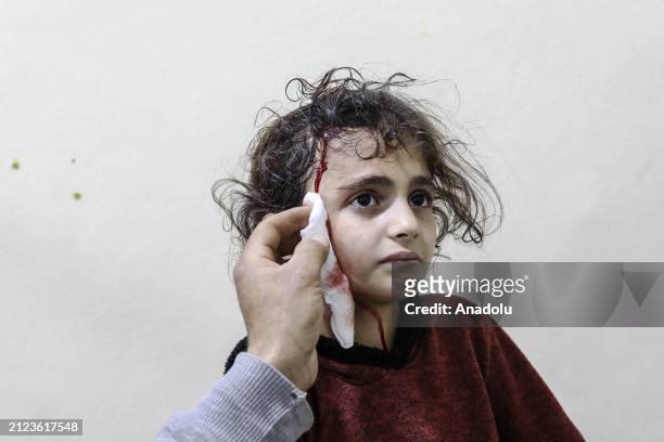 Doctor treats an injured child after the Syrian army's attack on Sarmin village of Idlib, Syria on April 01, 2024. After the attack, 2 civilians died...