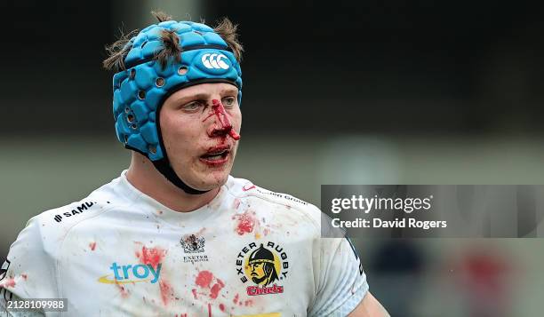 Blooded Ross Vintcent of Exeter Chiefs looks on during the Gallagher Premiership Rugby match between Sale Sharks and Exeter Chiefs at the AJ Bell...