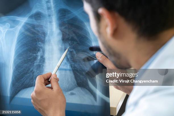 the doctor looking at chest x-ray film. - lunga bildbanksfoton och bilder